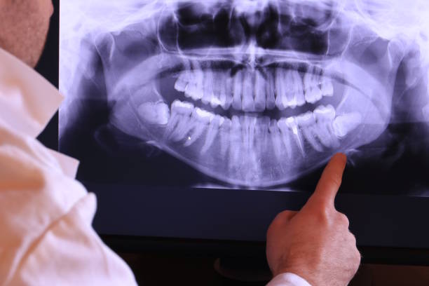 Best Emergency Root Canal Therapy in St Jaco, IL