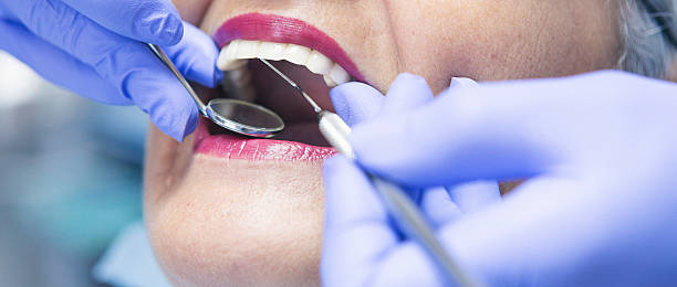 Best Lost Filling or Crown Replacement in St Jaco, IL